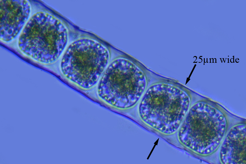 Zygogonium ericetorum